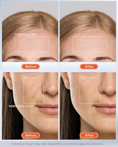 Radiant Glow LED Face Mask