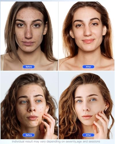 Radiant Glow LED Face Mask